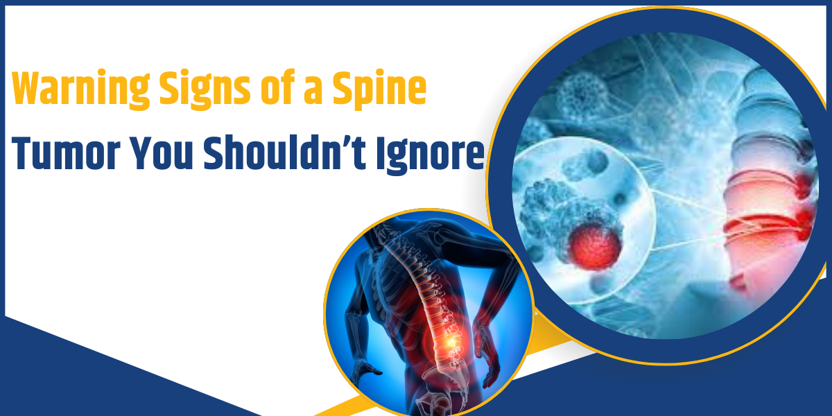 Warning Signs of a Spine Tumor You Shouldn’t Ignore