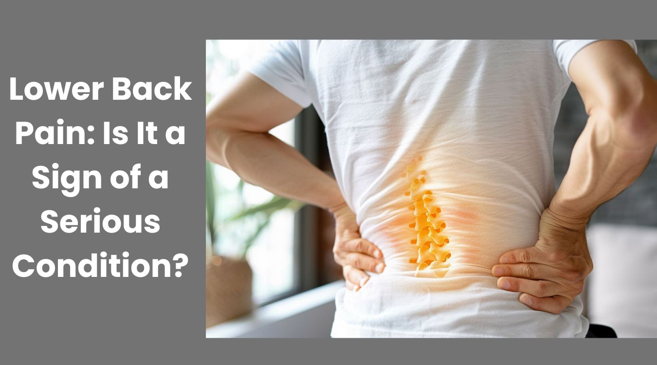 Lower Back Pain: Is It a Sign of a Serious Condition?