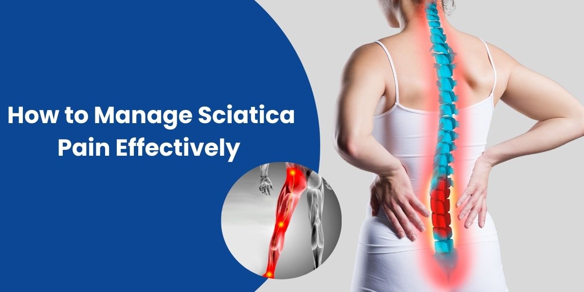 How to Manage Sciatica Pain Effectively