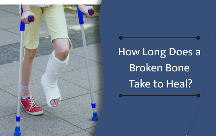 How Long Does a Broken Bone Take to Heal?