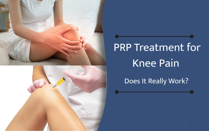 PRP Treatment for Knee Pain: Does It Really Work?