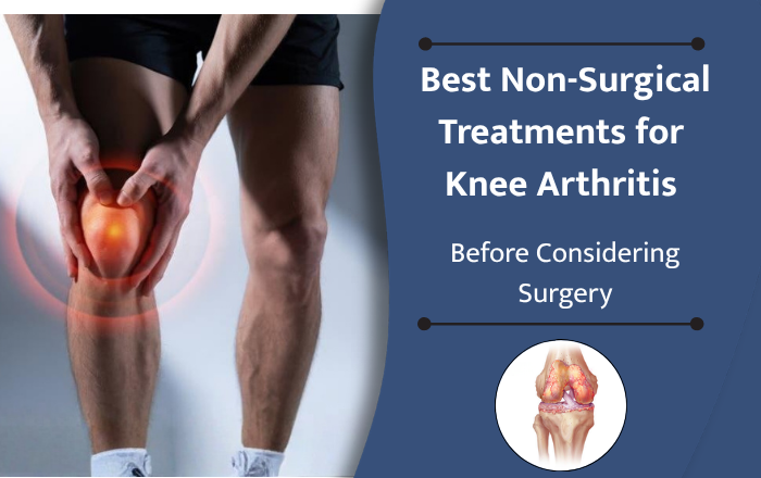 Best Non-Surgical Treatments for Knee Arthritis Before Considering Surgery